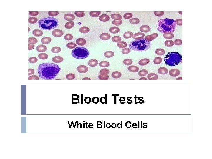 Blood Tests White Blood Cells 