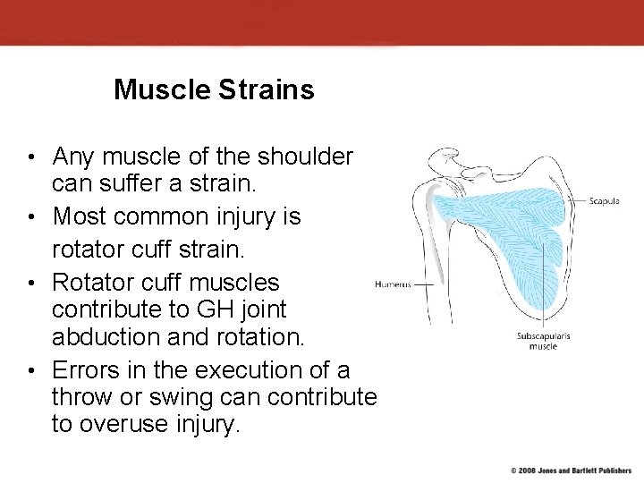 Muscle Strains • Any muscle of the shoulder can suffer a strain. • Most Muscle Strains • Any muscle of the shoulder can suffer a strain. • Most