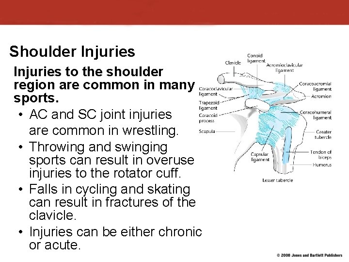 Shoulder Injuries to the shoulder region are common in many sports. • AC and Shoulder Injuries to the shoulder region are common in many sports. • AC and
