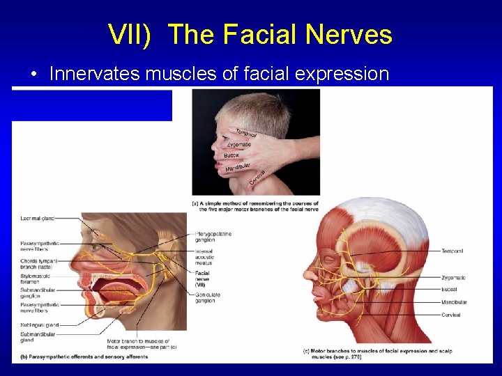 VII) The Facial Nerves • Innervates muscles of facial expression 