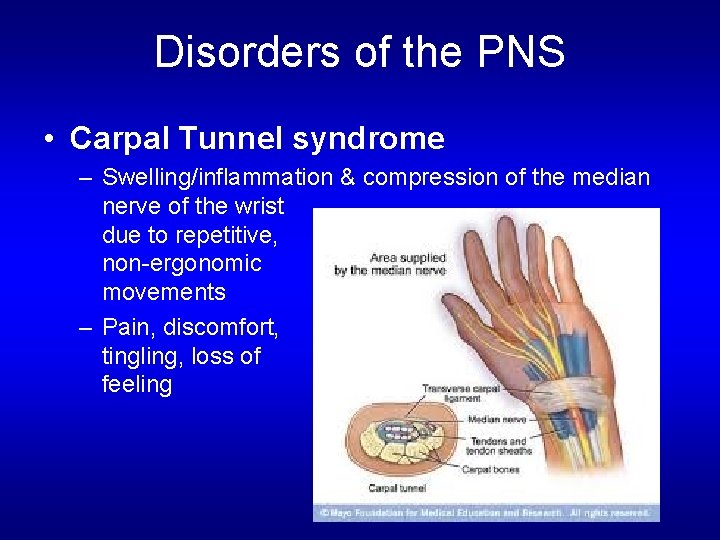 Disorders of the PNS • Carpal Tunnel syndrome – Swelling/inflammation & compression of the