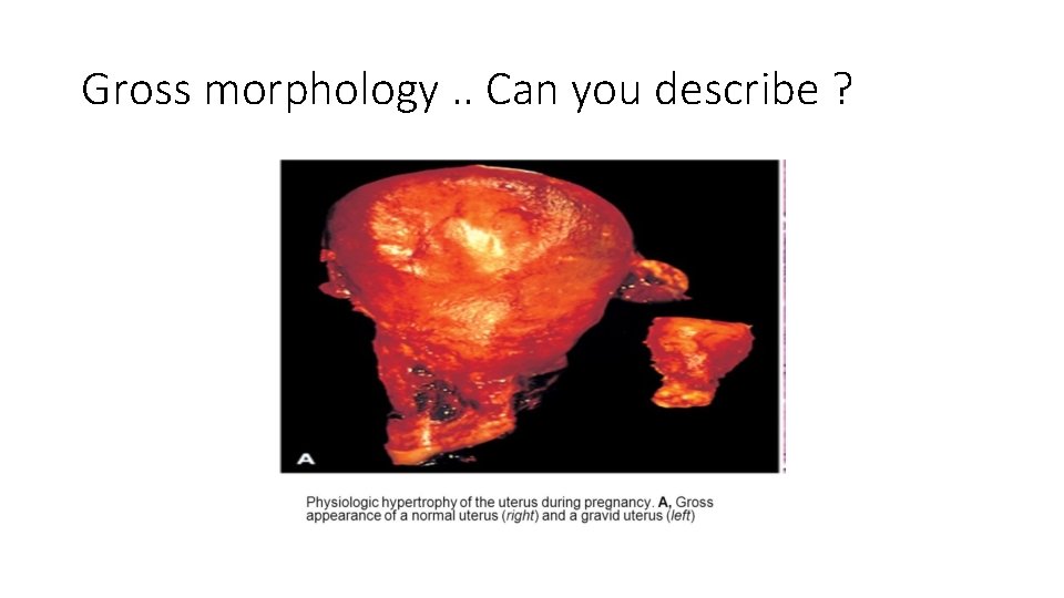 Gross morphology. . Can you describe ? 