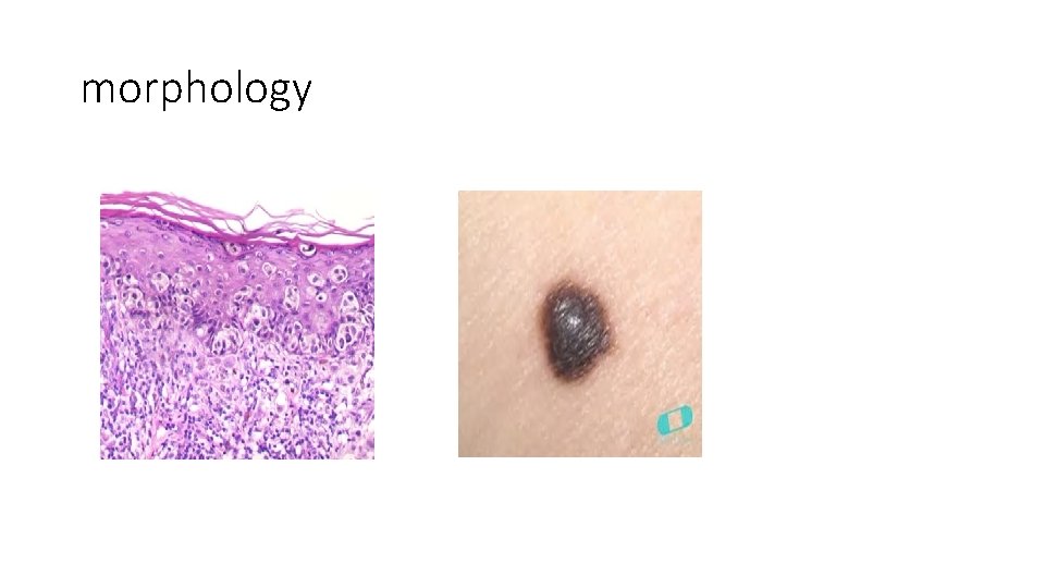 morphology morphology