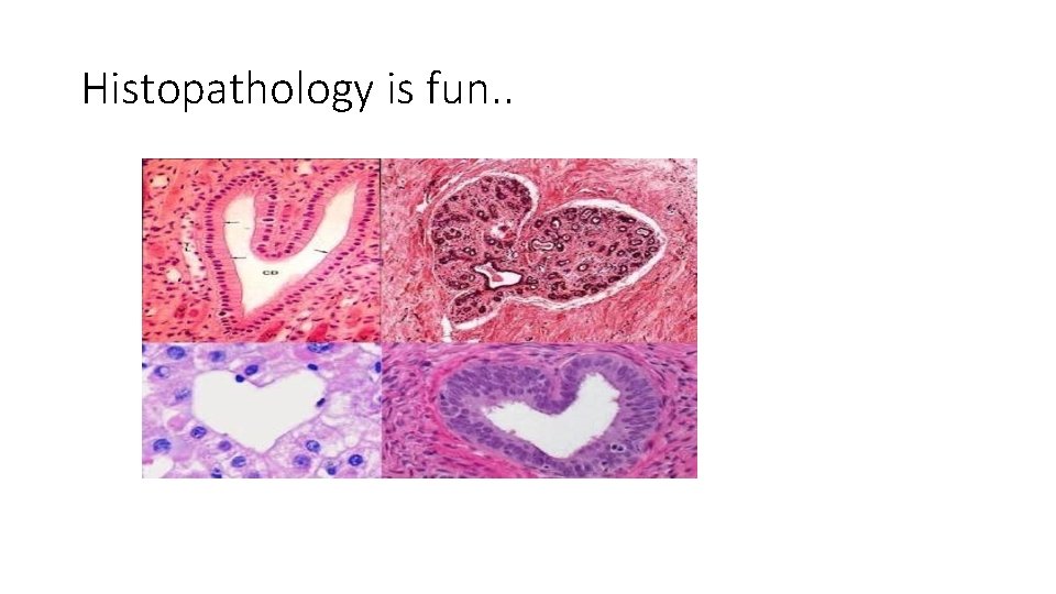 Histopathology is fun. . Histopathology is fun. .