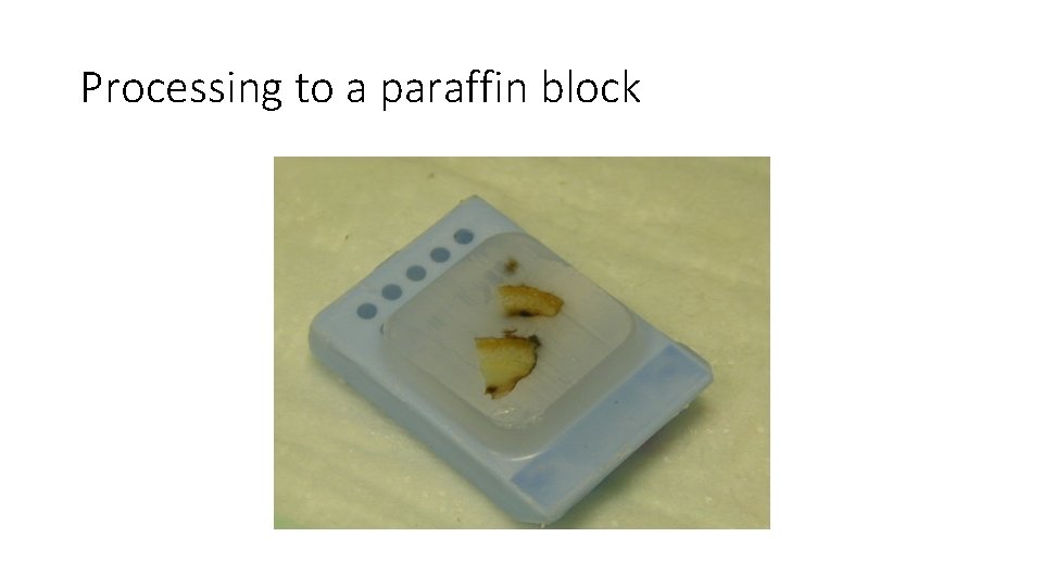 Processing to a paraffin block Processing to a paraffin block