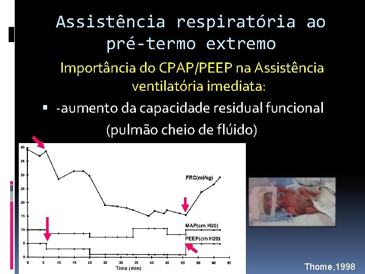 Assistência respiratória ao pré-termo extremo Importância do CPAP/PEEP na Assistência ventilatória imediata: -aumento da