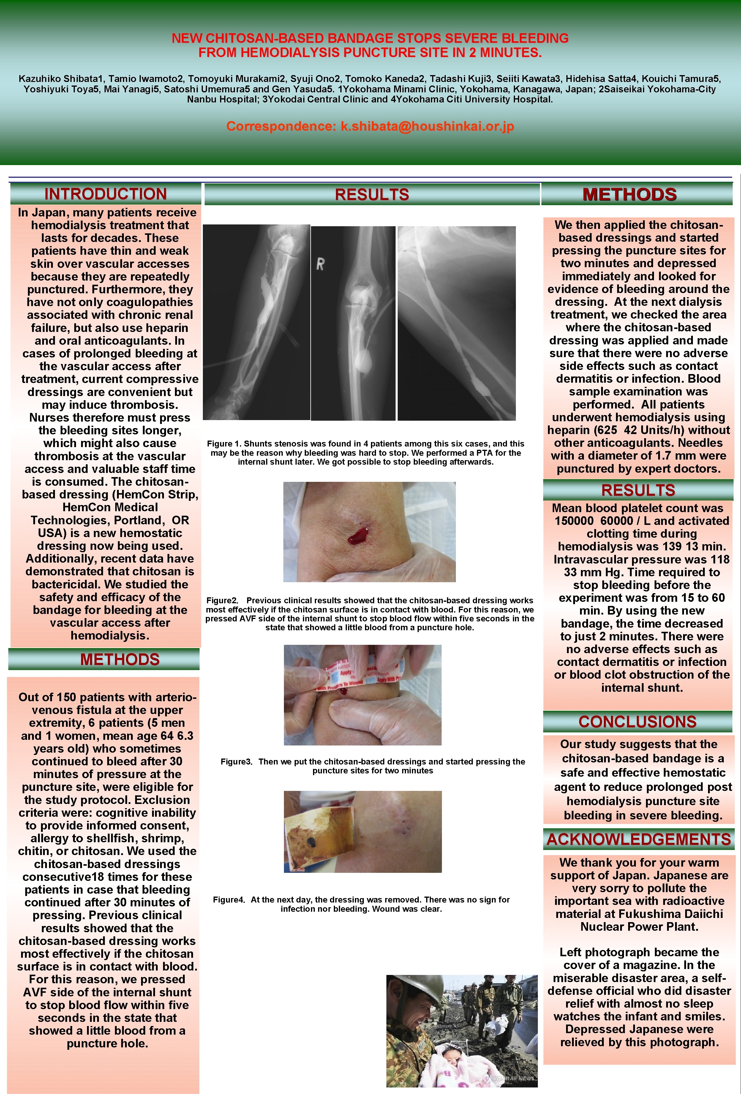 NEW CHITOSAN-BASED BANDAGE STOPS SEVERE BLEEDING FROM HEMODIALYSIS PUNCTURE SITE IN 2 MINUTES. Kazuhiko