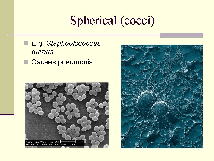 Spherical (cocci) n E. g. Staphoolococcus aureus n Causes pneumonia 