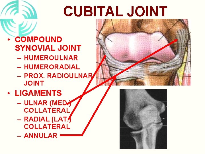 CUBITAL JOINT • COMPOUND SYNOVIAL JOINT – HUMEROULNAR – HUMERORADIAL – PROX. RADIOULNAR JOINT