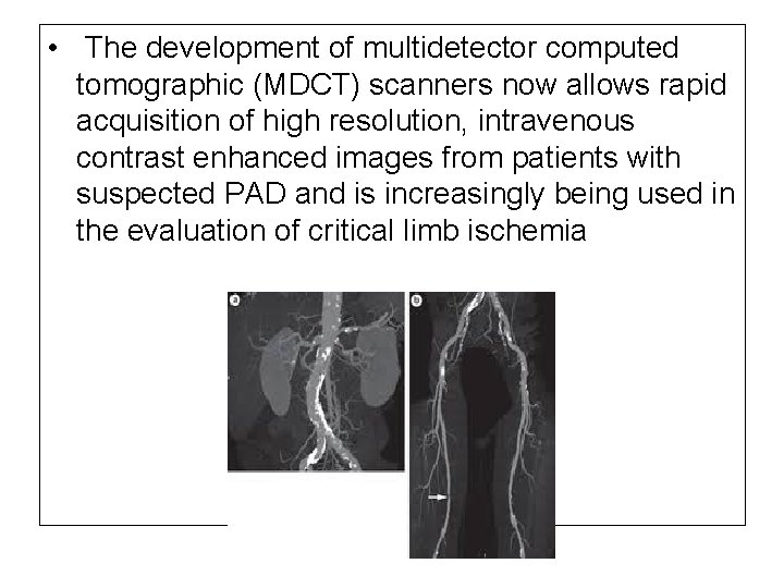  • The development of multidetector computed tomographic (MDCT) scanners now allows rapid acquisition