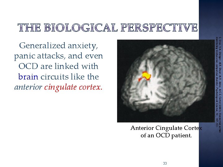 Anterior Cingulate Cortex of an OCD patient. 33 S. Ursu, V. A. Stenger, M.