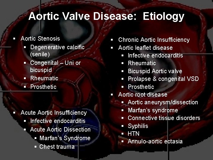 Aortic Valve Disease: Etiology § Aortic Stenosis § Degenerative calcific (senile) § Congenital –