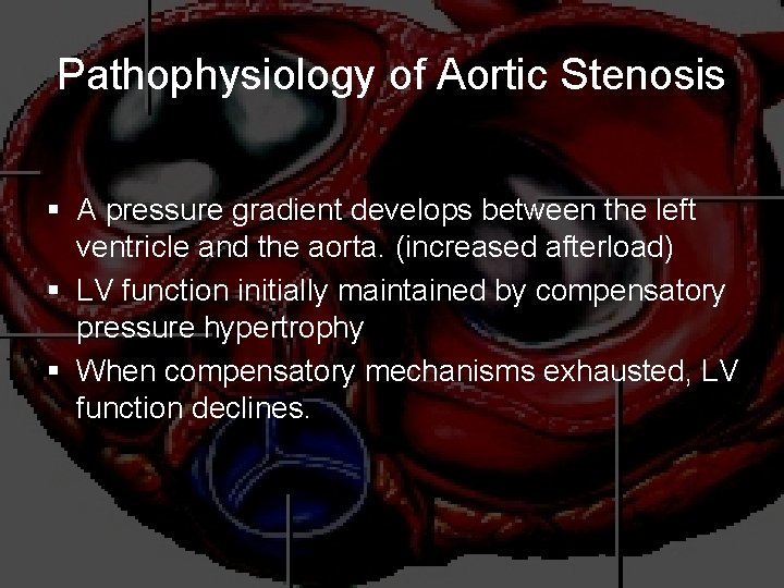 Pathophysiology of Aortic Stenosis § A pressure gradient develops between the left ventricle and