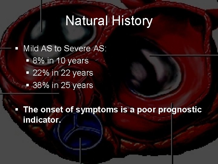 Natural History § Mild AS to Severe AS: § 8% in 10 years §