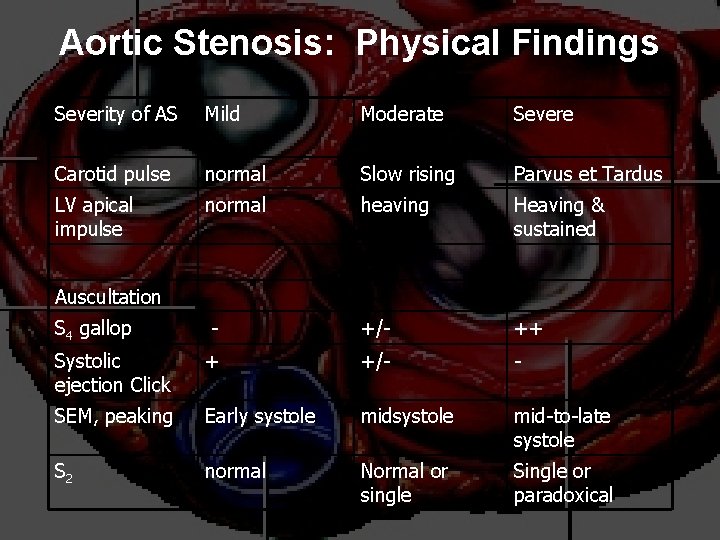 Aortic Stenosis: Physical Findings Severity of AS Mild Moderate Severe Carotid pulse normal Slow