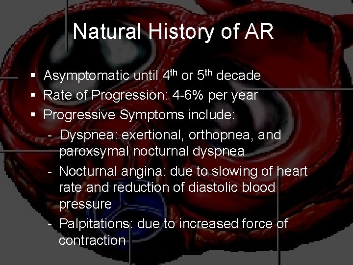 Natural History of AR § Asymptomatic until 4 th or 5 th decade §