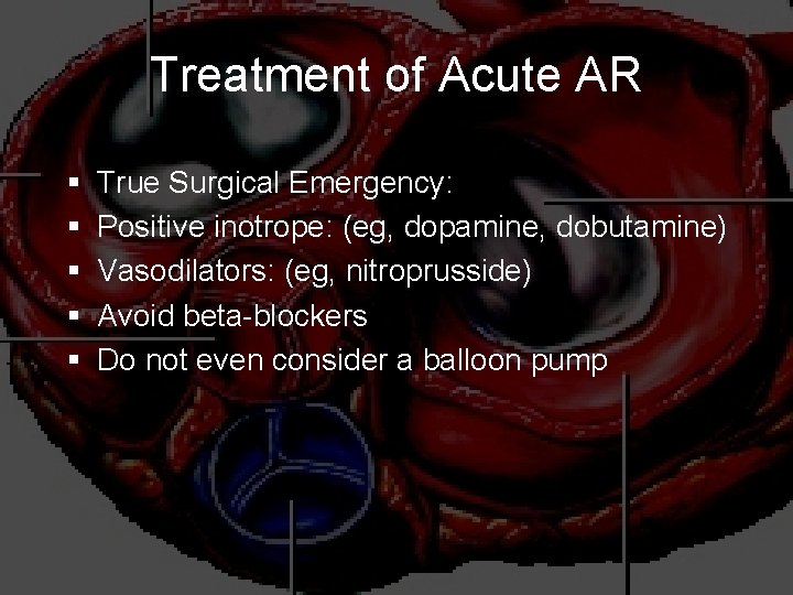 Treatment of Acute AR § § § True Surgical Emergency: Positive inotrope: (eg, dopamine,
