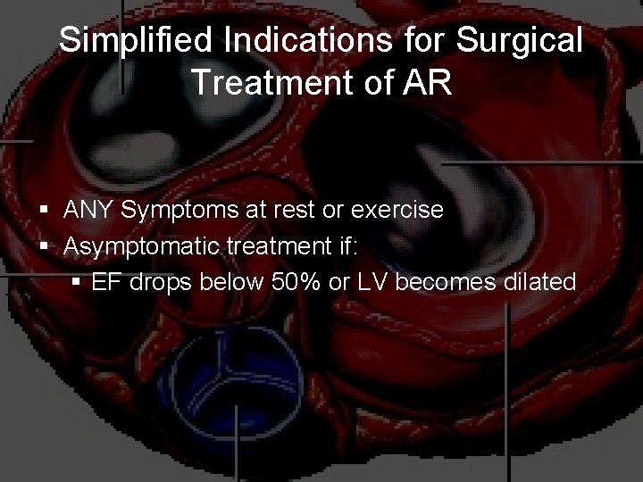 Simplified Indications for Surgical Treatment of AR § ANY Symptoms at rest or exercise