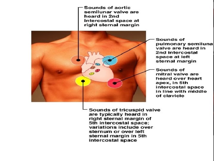 Places to auscultate 5 