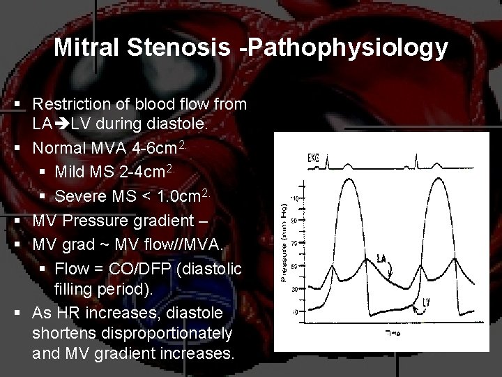 Mitral Stenosis -Pathophysiology § Restriction of blood flow from LA LV during diastole. §