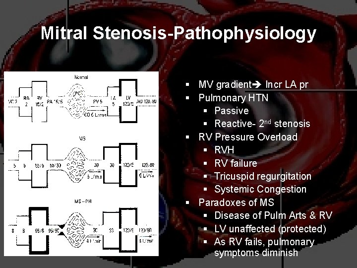 Mitral Stenosis-Pathophysiology § MV gradient Incr LA pr § Pulmonary HTN § Passive §