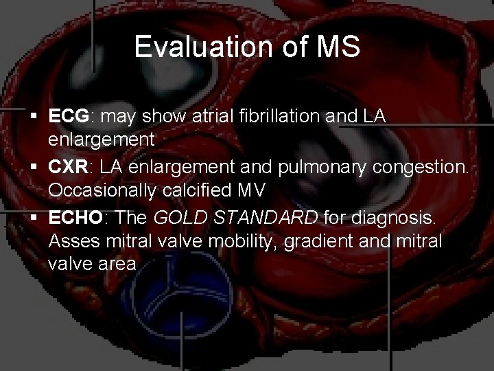 Evaluation of MS § ECG: may show atrial fibrillation and LA enlargement § CXR:
