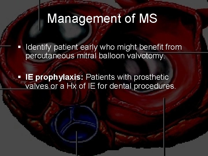 Management of MS § Identify patient early who might benefit from percutaneous mitral balloon