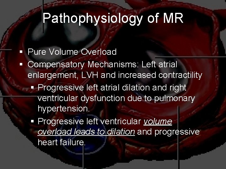 Pathophysiology of MR § Pure Volume Overload § Compensatory Mechanisms: Left atrial enlargement, LVH