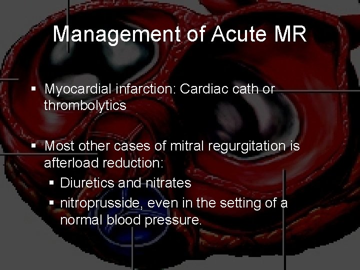 Management of Acute MR § Myocardial infarction: Cardiac cath or thrombolytics § Most other