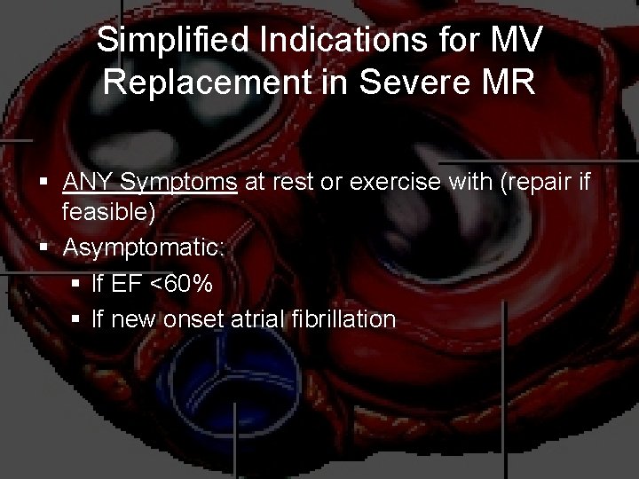 Simplified Indications for MV Replacement in Severe MR § ANY Symptoms at rest or