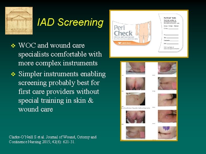 IAD Screening v v WOC and wound care specialists comfortable with more complex instruments IAD Screening v v WOC and wound care specialists comfortable with more complex instruments