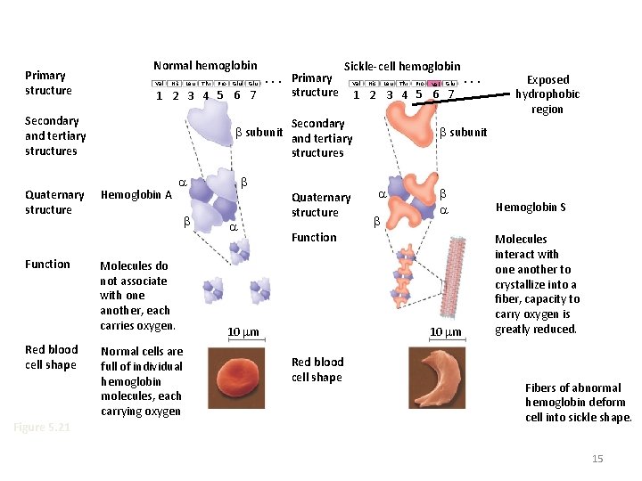 Primary structure Normal hemoglobin Primary Val His Leu Thr Pro Glul Glu. . .