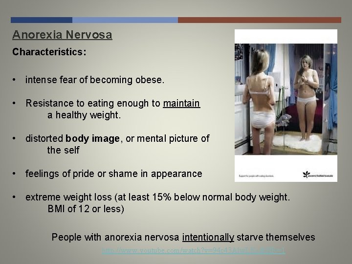 Anorexia Nervosa Characteristics: • intense fear of becoming obese. • Resistance to eating enough