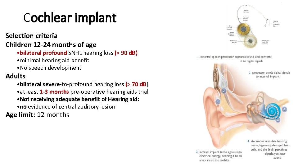 Cochlear implant Selection criteria Children 12 -24 months of age • bilateral profound SNHL