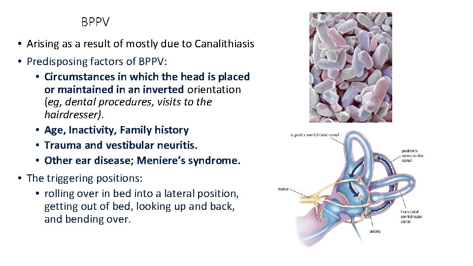BPPV • Arising as a result of mostly due to Canalithiasis • Predisposing factors