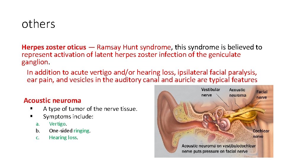 others Herpes zoster oticus — Ramsay Hunt syndrome, this syndrome is believed to represent