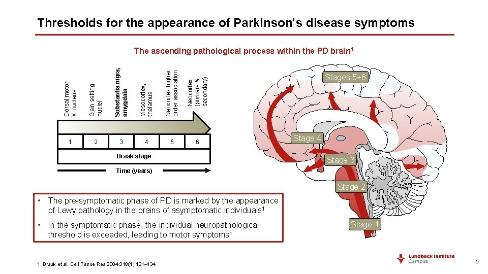 Thresholds for the appearance of Parkinson’s disease symptoms Dorsal motor X nucleus Gain setting Thresholds for the appearance of Parkinson’s disease symptoms Dorsal motor X nucleus Gain setting
