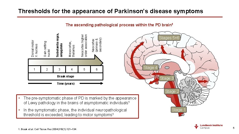 Thresholds for the appearance of Parkinson’s disease symptoms Dorsal motor X nucleus Gain setting