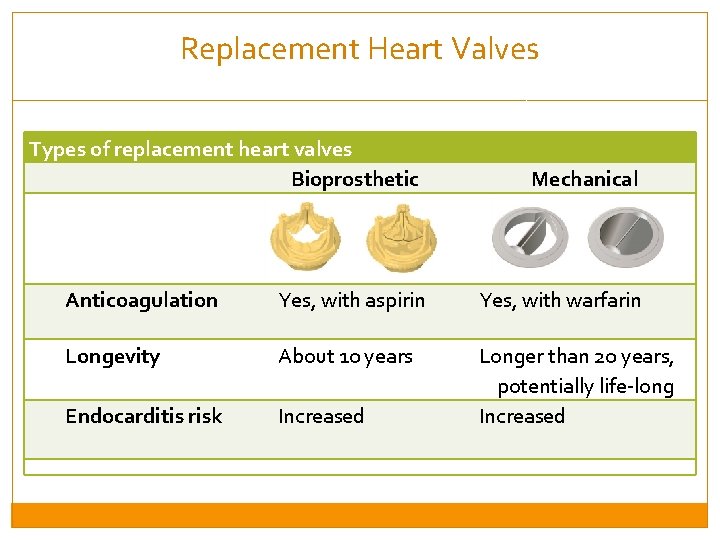 Replacement Heart Valves Types of replacement heart valves Bioprosthetic Mechanical Anticoagulation Yes, with aspirin
