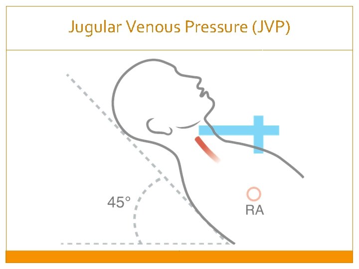 Jugular Venous Pressure (JVP) 