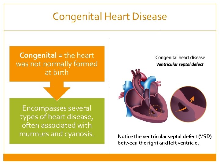 Congenital Heart Disease Congenital = the heart was not normally formed at birth Encompasses