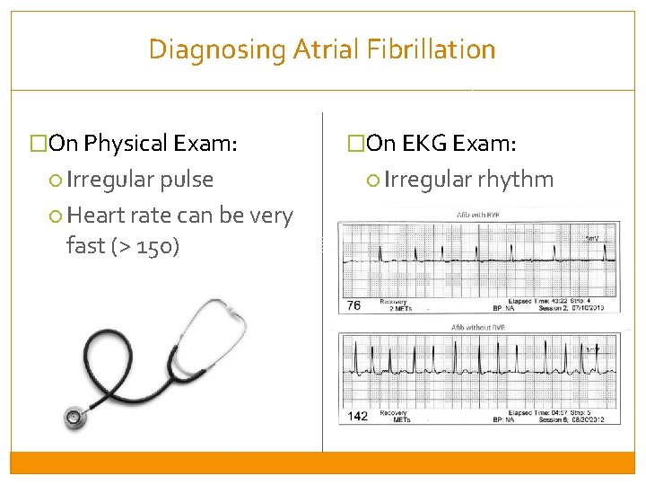 Diagnosing Atrial Fibrillation �On Physical Exam: Irregular pulse Heart rate can be very fast