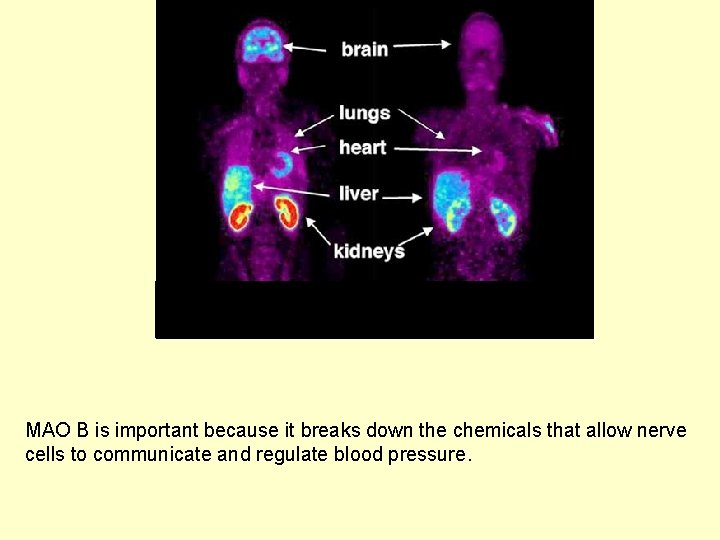  shows the concentration of radioactive tracer bound to monoamine oxidase B (MAO B).