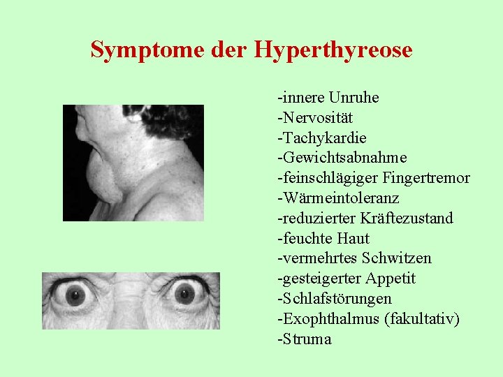 Symptome der Hyperthyreose -innere Unruhe -Nervosität -Tachykardie -Gewichtsabnahme -feinschlägiger Fingertremor -Wärmeintoleranz -reduzierter Kräftezustand -feuchte