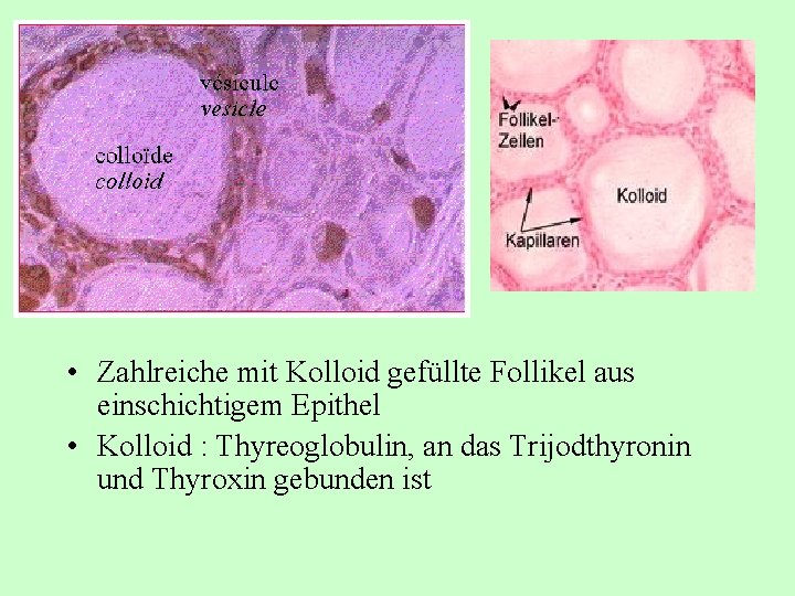  • Zahlreiche mit Kolloid gefüllte Follikel aus einschichtigem Epithel • Kolloid : Thyreoglobulin,