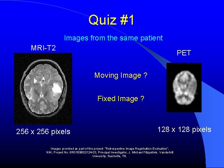 Quiz #1 Images from the same patient MRI-T 2 PET Moving Image ? Fixed