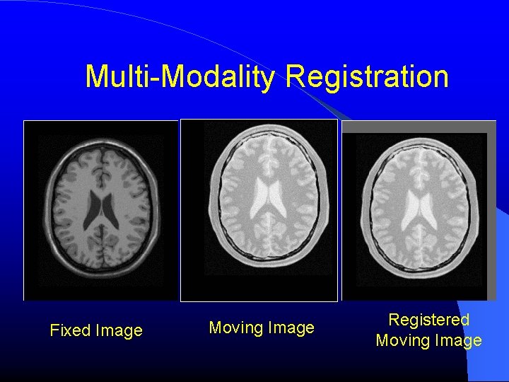 Multi-Modality Registration Fixed Image Moving Image Registered Moving Image 