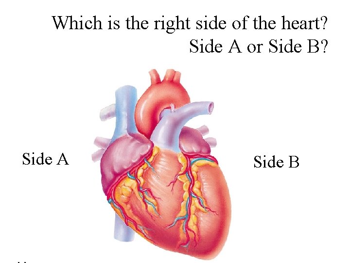 Which is the right side of the heart? Side A or Side B? Side