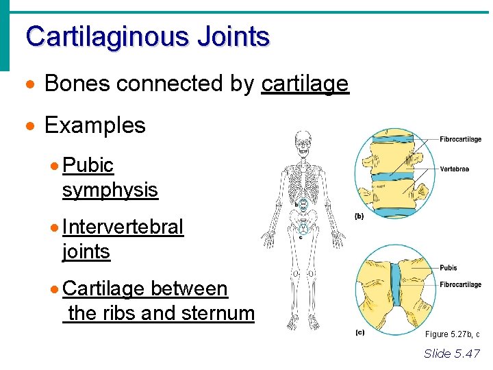 Cartilaginous Joints Bones connected by cartilage Examples Pubic symphysis Intervertebral joints Cartilage between the