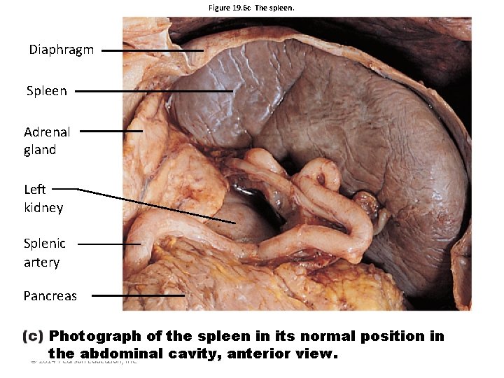 Figure 19. 6 c The spleen. Diaphragm Spleen Adrenal gland Left kidney Splenic artery